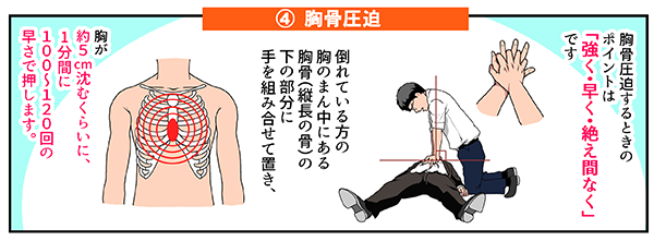 AEDの使い方「胸骨圧迫」
