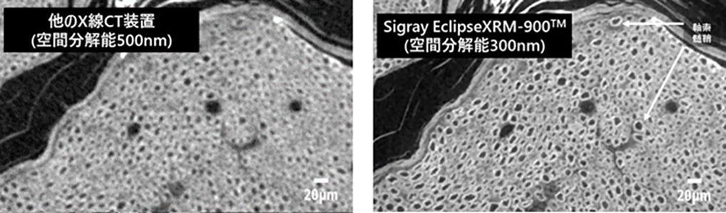 マウスの坐骨神経サンプル画像